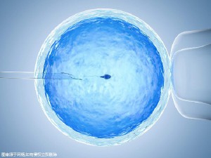 生殖科主任